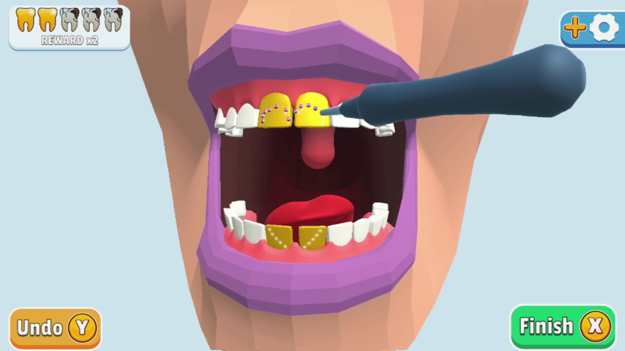 牙齿装饰.Dentist Bling