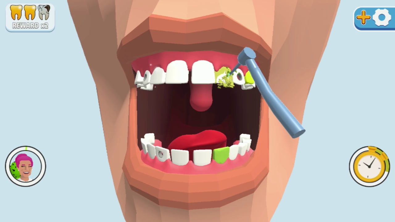 牙齿装饰.Dentist Bling