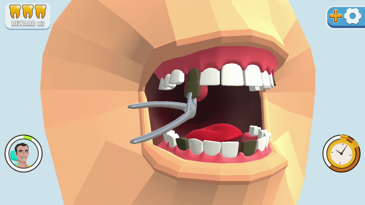 牙齿装饰.Dentist Bling