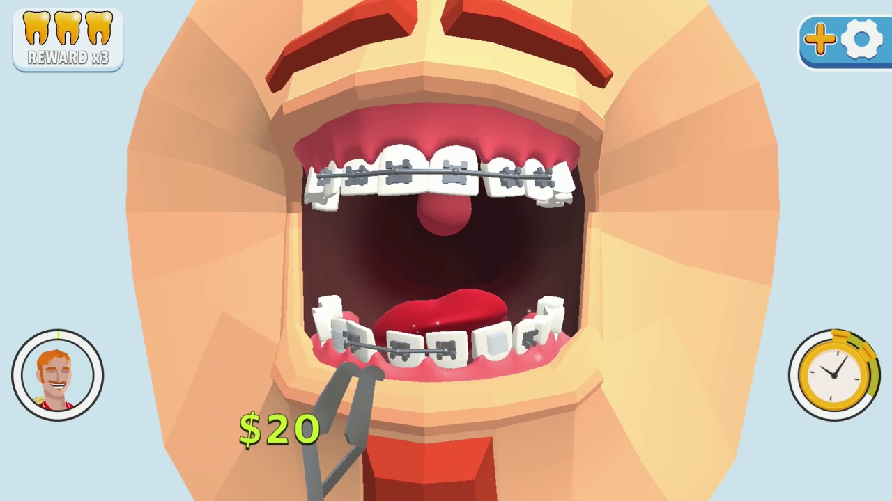 牙齿装饰.Dentist Bling